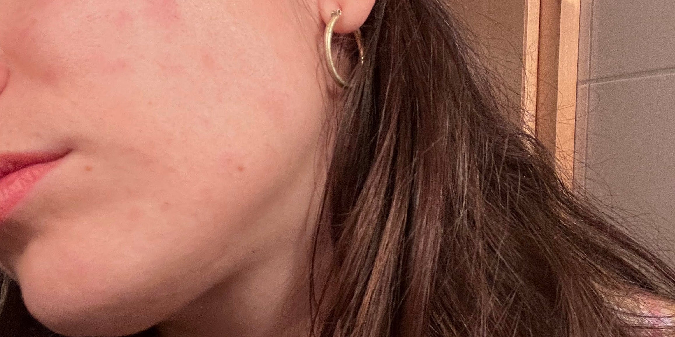 Why Sensitive Skin Suddenly Reacts to Everything