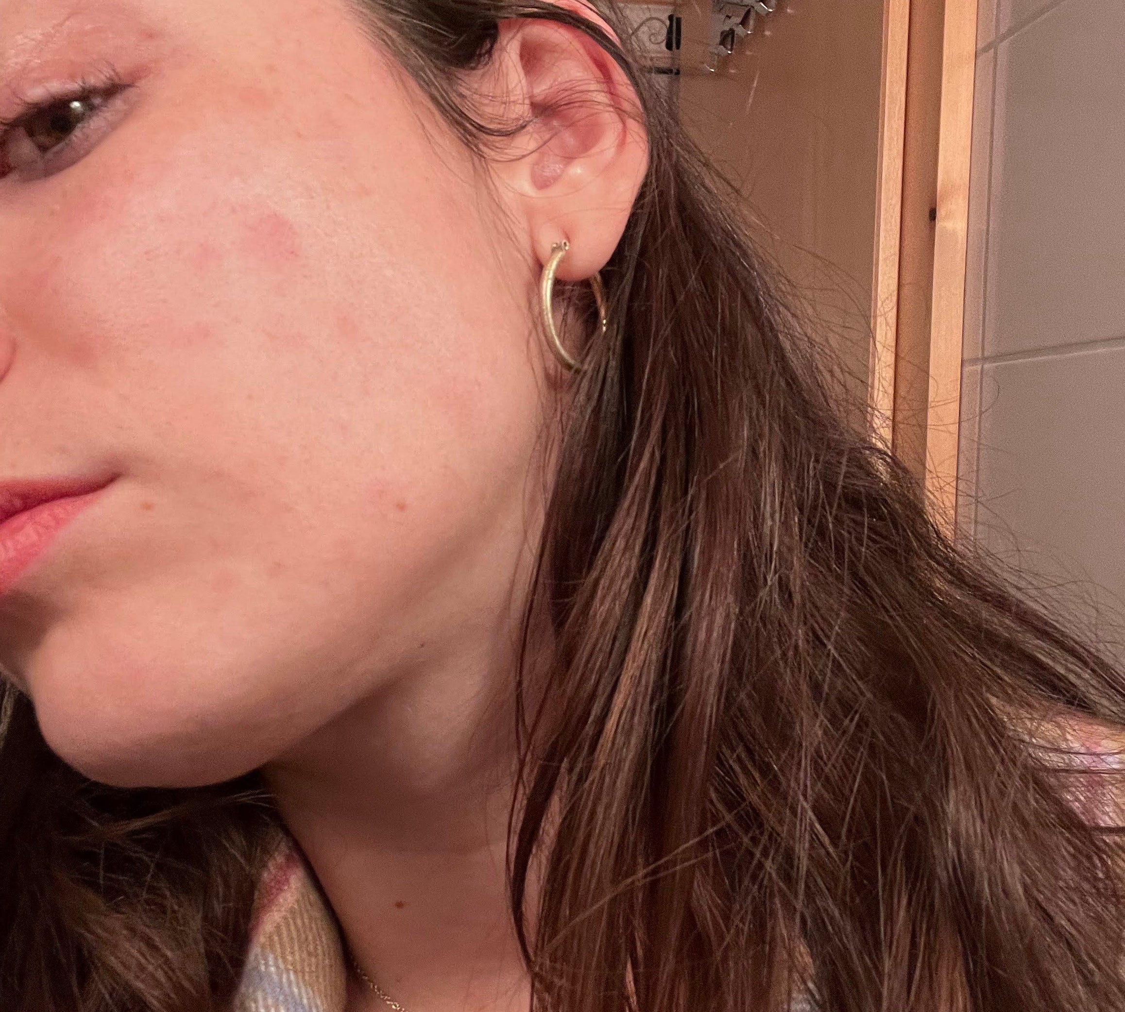 Why Sensitive Skin Suddenly Reacts to Everything