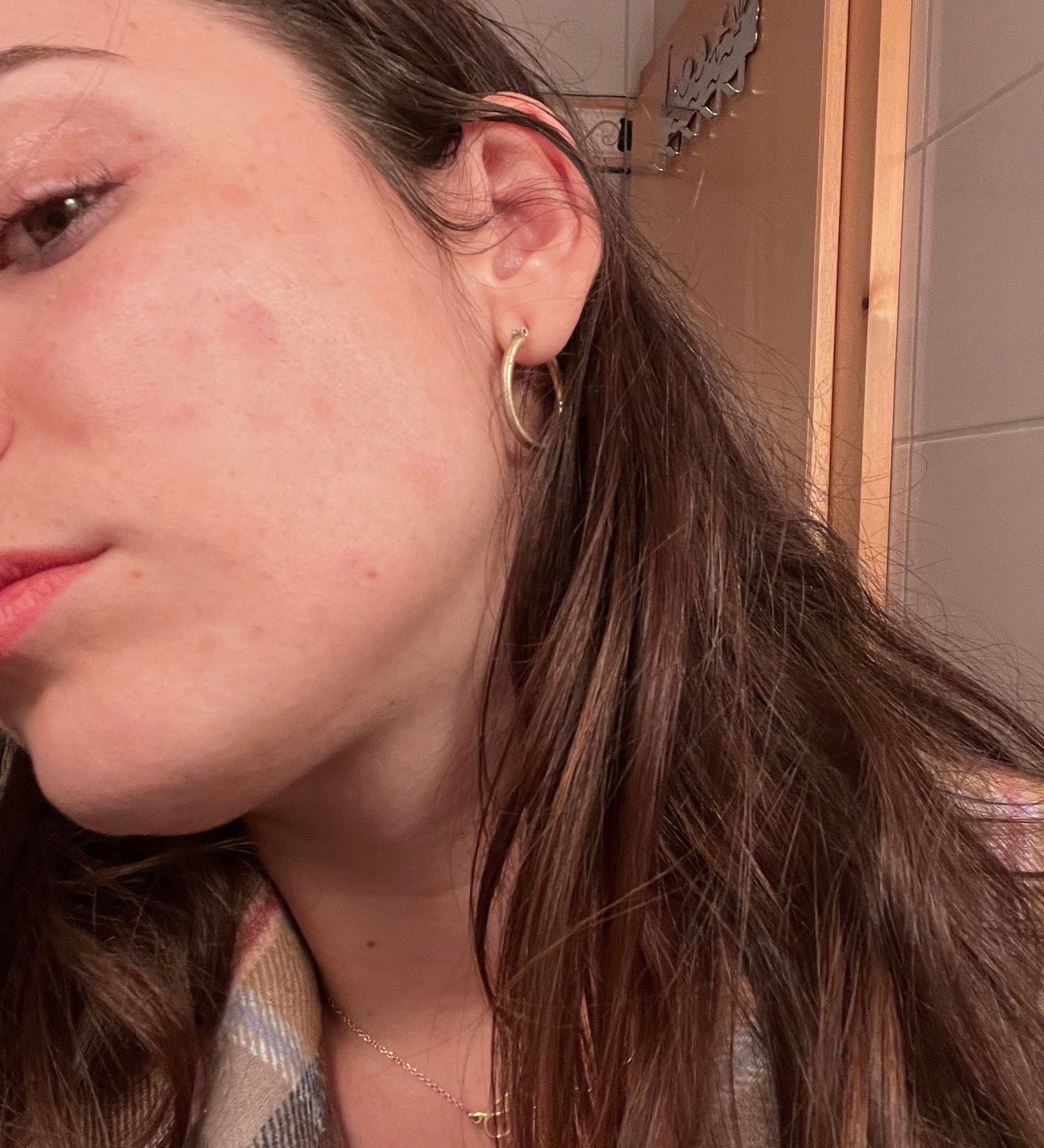 Why Sensitive Skin Suddenly Reacts to Everything