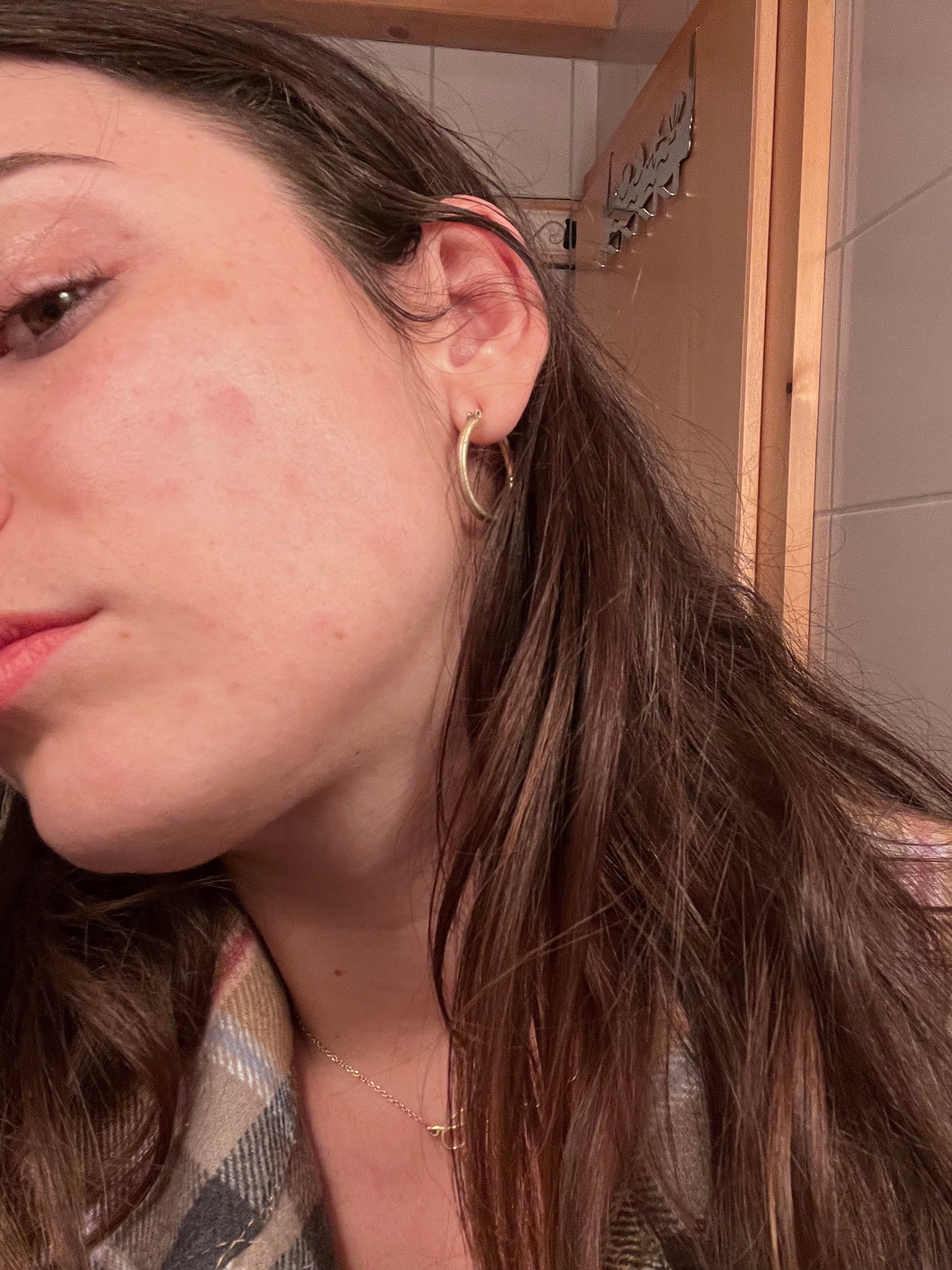 Why Sensitive Skin Suddenly Reacts to Everything