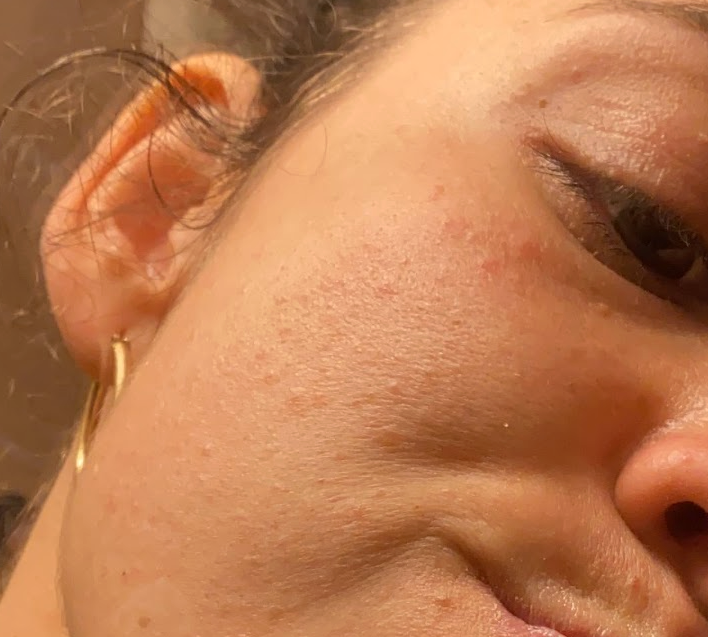Close-up of a woman's cheek and ear